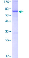 FASN / Fatty Acid Synthase Protein - 12.5% SDS-PAGE of human FASN stained with Coomassie Blue