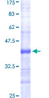 FASN / Fatty Acid Synthase Protein - 12.5% SDS-PAGE Stained with Coomassie Blue.