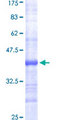 FASN / Fatty Acid Synthase Protein - 12.5% SDS-PAGE Stained with Coomassie Blue.