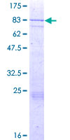 FASTK / FAST Protein - 12.5% SDS-PAGE of human FASTK stained with Coomassie Blue