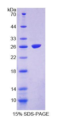 FASTK / FAST Protein - Recombinant Fas Activated Serine/Threonine Kinase By SDS-PAGE