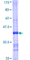 FASTKD2 Protein - 12.5% SDS-PAGE Stained with Coomassie Blue.