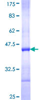 FASTKD5 Protein - 12.5% SDS-PAGE Stained with Coomassie Blue.
