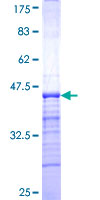 FATE1 Protein - 12.5% SDS-PAGE Stained with Coomassie Blue.