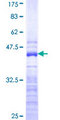 FAU / Fub1 Protein - 12.5% SDS-PAGE Stained with Coomassie Blue.