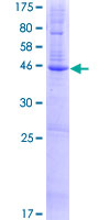 FAXDC2 / C5orf4 Protein - 12.5% SDS-PAGE of human C5orf4 stained with Coomassie Blue