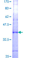 FBG4 / FBXO17 Protein - 12.5% SDS-PAGE Stained with Coomassie Blue.