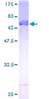 FBL8 / FBXL8 Protein - 12.5% SDS-PAGE of human FBXL8 stained with Coomassie Blue