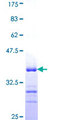 FBLIM1 / Migfilin Protein - 12.5% SDS-PAGE Stained with Coomassie Blue.