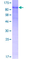 FBLN1 / Fibulin 1 Protein - 12.5% SDS-PAGE of human FBLN1 stained with Coomassie Blue