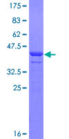 FBLN1 / Fibulin 1 Protein - 12.5% SDS-PAGE Stained with Coomassie Blue.