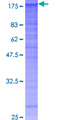 FBLN2 / Fibulin 2 Protein - 12.5% SDS-PAGE of human FBLN2 stained with Coomassie Blue