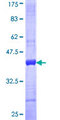 FBLN2 / Fibulin 2 Protein - 12.5% SDS-PAGE Stained with Coomassie Blue.