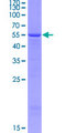 FBLN4 / EFEMP2 Protein - 12.5% SDS-PAGE of human EFEMP2 stained with Coomassie Blue
