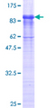 FBLN4 / EFEMP2 Protein - 12.5% SDS-PAGE of human EFEMP2 stained with Coomassie Blue