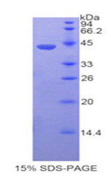FBLN4 / EFEMP2 Protein - Recombinant Fibulin 4 By SDS-PAGE