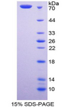 FBLN4 / EFEMP2 Protein - Recombinant Fibulin 4 By SDS-PAGE