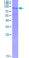 FBLN5 / Fibulin 5 Protein - 12.5% SDS-PAGE of human FBLN5 stained with Coomassie Blue