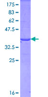 FBN1 / Fibrillin 1 Protein - 12.5% SDS-PAGE Stained with Coomassie Blue.