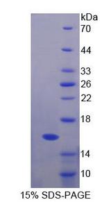 FBN1 / Fibrillin 1 Protein - Recombinant Fibrillin 1 (FBN1) by SDS-PAGE