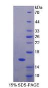 FBN1 / Fibrillin 1 Protein - Recombinant Fibrillin 1 (FBN1) by SDS-PAGE