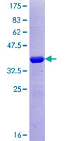 FBN2 / Fibrillin 2 Protein - 12.5% SDS-PAGE Stained with Coomassie Blue.