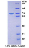 FBN3 Protein - Recombinant Fibrillin 3 By SDS-PAGE