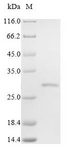 FBP / FOLR2 Protein - (Tris-Glycine gel) Discontinuous SDS-PAGE (reduced) with 5% enrichment gel and 15% separation gel.