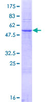 FBP / FOLR2 Protein - 12.5% SDS-PAGE of human FOLR2 stained with Coomassie Blue