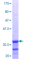 FBP / FOLR2 Protein - 12.5% SDS-PAGE Stained with Coomassie Blue.