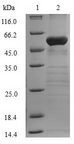 FBP1 Protein - (Tris-Glycine gel) Discontinuous SDS-PAGE (reduced) with 5% enrichment gel and 15% separation gel.
