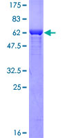 FBP1 Protein - 12.5% SDS-PAGE of human FBP1 stained with Coomassie Blue