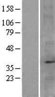 FBP2 Protein - Western validation with an anti-DDK antibody * L: Control HEK293 lysate R: Over-expression lysate