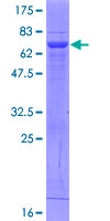 FBP2 Protein - 12.5% SDS-PAGE of human FBP2 stained with Coomassie Blue