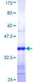 FBP2 Protein - 12.5% SDS-PAGE Stained with Coomassie Blue.