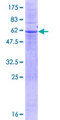 FBX23 / Tetraspanin 17 Protein - 12.5% SDS-PAGE of human TSPAN17 stained with Coomassie Blue