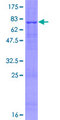 FBXL16 Protein - 12.5% SDS-PAGE of human FBXL16 stained with Coomassie Blue