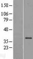 FBXL17 Protein - Western validation with an anti-DDK antibody * L: Control HEK293 lysate R: Over-expression lysate