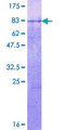 FBXL17 Protein - 12.5% SDS-PAGE of human FBXL17 stained with Coomassie Blue