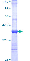 FBXL17 Protein - 12.5% SDS-PAGE Stained with Coomassie Blue.