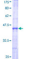 FBXL18 Protein - 12.5% SDS-PAGE Stained with Coomassie Blue.