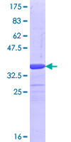 FBXL19 Protein - 12.5% SDS-PAGE Stained with Coomassie Blue.