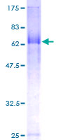 FBXL20 Protein - 12.5% SDS-PAGE of human FBXL20 stained with Coomassie Blue