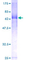 FBXL20 Protein - 12.5% SDS-PAGE of human FBXL20 stained with Coomassie Blue
