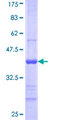 FBXL22 Protein - 12.5% SDS-PAGE Stained with Coomassie Blue.