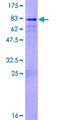 FBXL3 Protein - 12.5% SDS-PAGE of human FBXL3 stained with Coomassie Blue