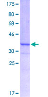 FBXL3 Protein - 12.5% SDS-PAGE Stained with Coomassie Blue.