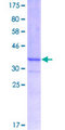FBXL3 Protein - 12.5% SDS-PAGE Stained with Coomassie Blue.
