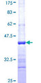 FBXL4 / FBL5 Protein - 12.5% SDS-PAGE Stained with Coomassie Blue.