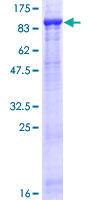 FBXL5 / FBL5 Protein - 12.5% SDS-PAGE of human FBXL5 stained with Coomassie Blue
